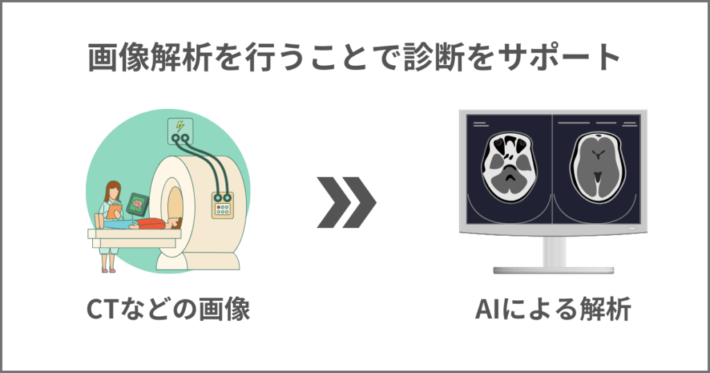画像解析を行うことで診断をサポート